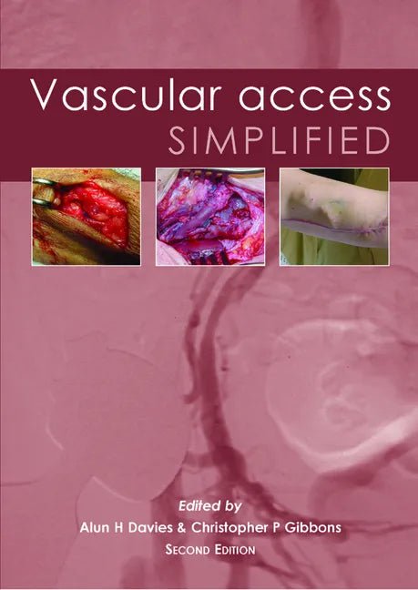 Vascular Access Simplified; Second Edition - Paperback
