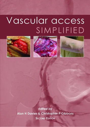 Vascular Access Simplified; Second Edition - Paperback
