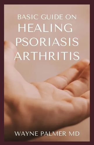 Basic Guide on Healing Psoriasis Arthritis: The Essential Recipe Cookbook To Help You Soothe Your Symptoms - Paperback