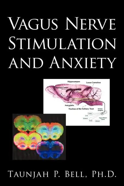 Vagus Nerve Stimulation and Anxiety - Paperback