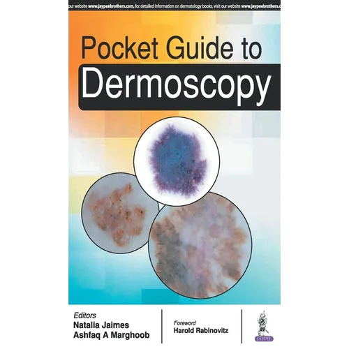 Pocket Guide to Dermoscopy - Paperback