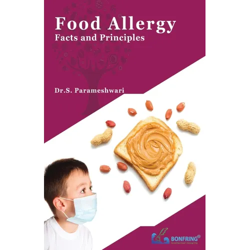 Food Allergy-Facts and Principles - Paperback