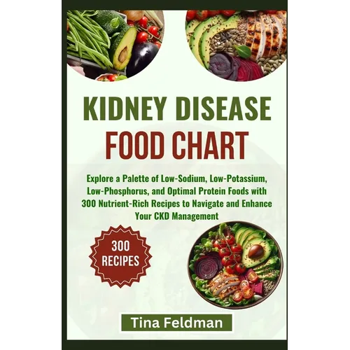 Kidney Disease Food Chart: Explore a Palette of Low-Sodium, Low-Potassium, Low-Phosphorus, and Optimal Protein Foods with 300 Nutrient-Rich Recip - Paperback