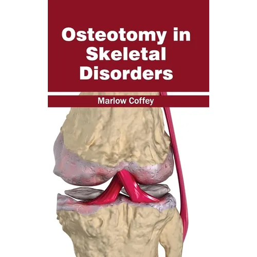Osteotomy in Skeletal Disorders - Hardcover