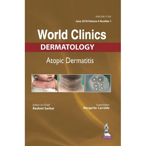 World Clinics-Atopic Dermatitis (June 2018, Vol.04 Issue 1) - Hardcover