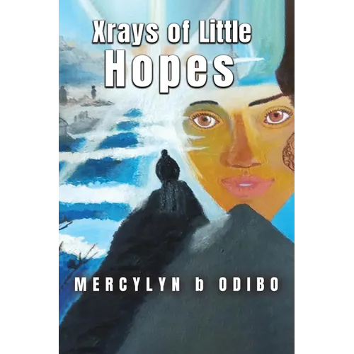 Xrays Of Little Hopes - Paperback