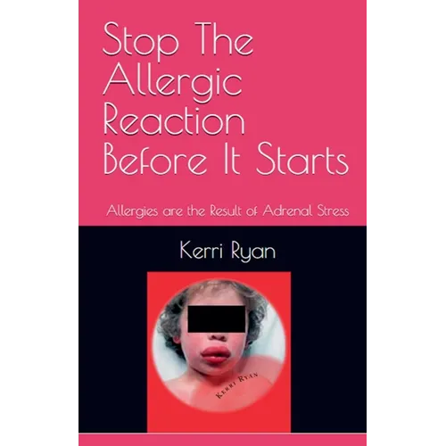 Stop the Allergic Reaction Before It Starts - Paperback