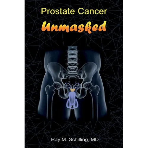 Prostate Cancer Unmasked - Paperback