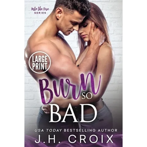 Burn So Bad - Paperback