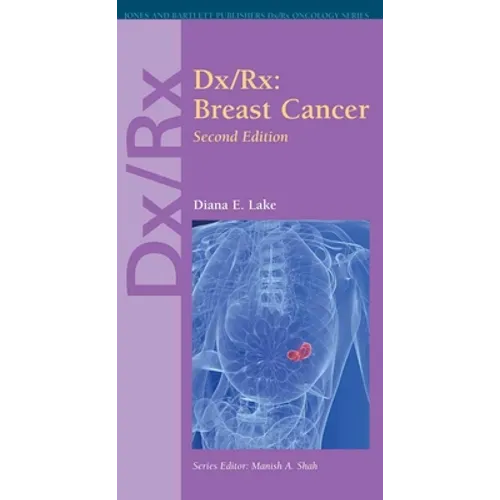 DX/Rx: Breast Cancer: . - Paperback