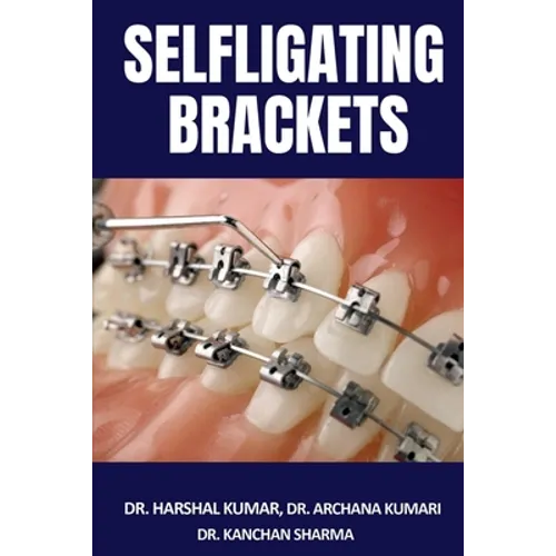 Selfligating Brackets - Paperback