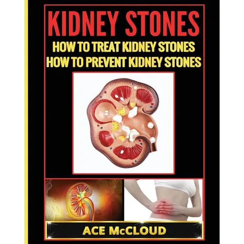 Kidney Stones: How To Treat Kidney Stones: How To Prevent Kidney Stones - Paperback