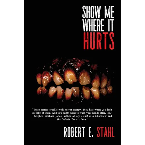 Show Me Where It Hurts - Paperback
