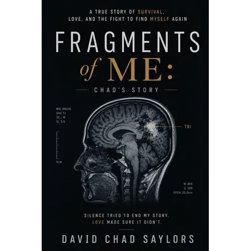 Fragments of Me Chad's Story - Paperback