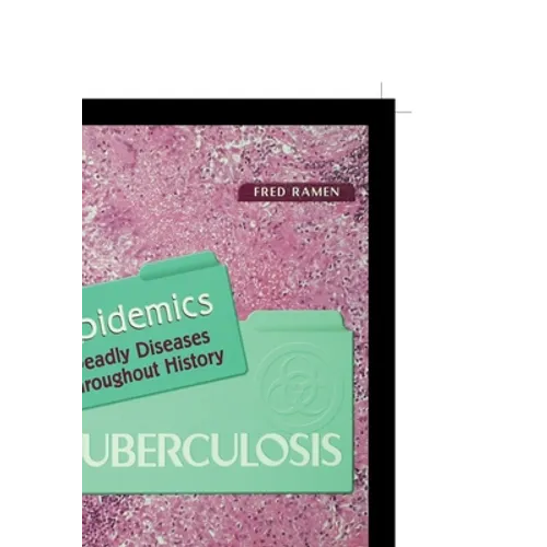 Tuberculosis - Paperback