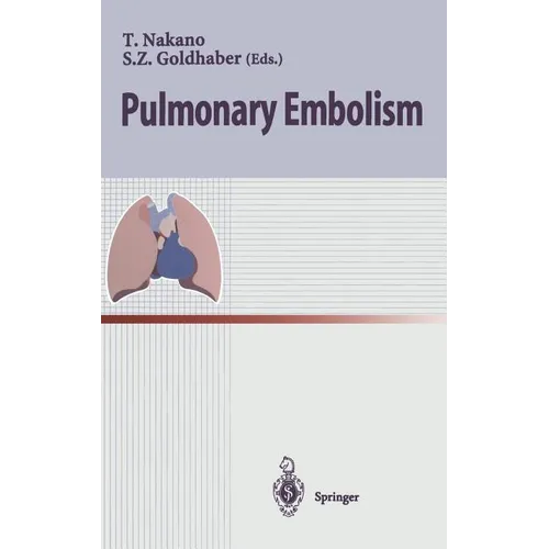 Pulmonary Embolism - Hardcover