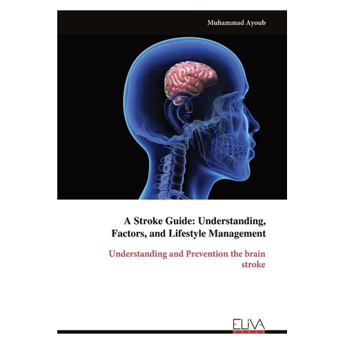 A Stroke Guide: Understanding, Factors, and Lifestyle Management: Understanding and Prevention the brainstroke - Paperback