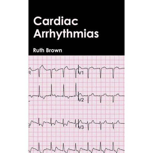 Cardiac Arrhythmias - Hardcover