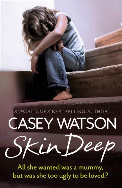 Skin Deep: All she wanted was a mummy, but was she too ugly to be loved? - Paperback