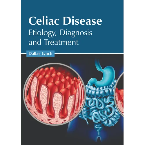 Celiac Disease: Etiology, Diagnosis and Treatment - Hardcover
