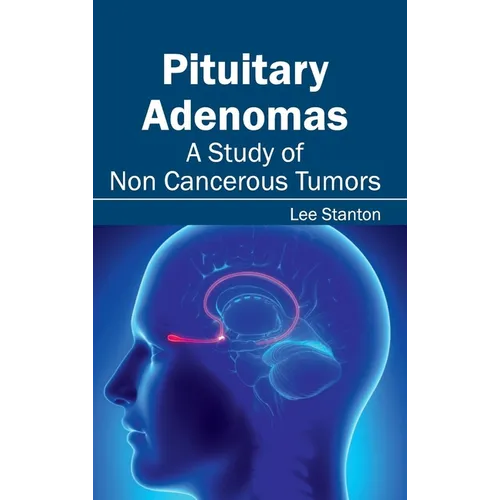 Pituitary Adenomas: A Study of Non Cancerous Tumors - Hardcover