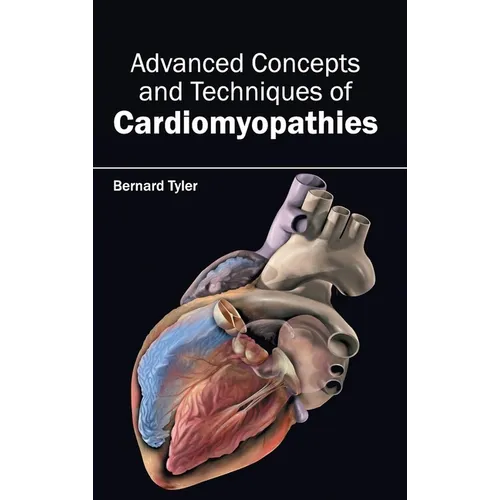Advanced Concepts and Techniques of Cardiomyopathies - Hardcover