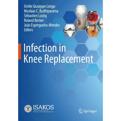 Infection in Knee Replacement - Paperback