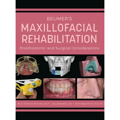 Beumer's Maxillofacial Rehabilitation: Prosthodontics and Surgical Considerations - Hardcover