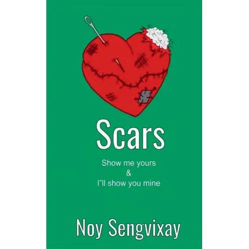Scars - Paperback