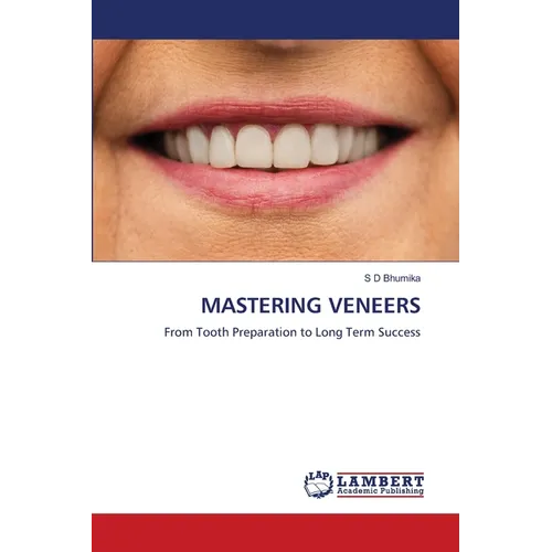 Mastering Veneers - Paperback