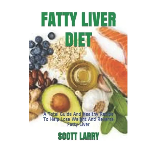 Fatty Liver Diet: A Total Guide And Healthy Recipe To Help Lose Weight And Reverse Fatty Liver - Paperback