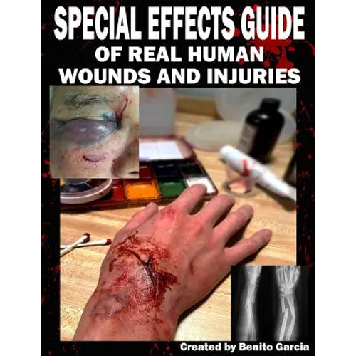 Special Effects Guide Of Real Human Wounds and Injuries: Special Effects Guide Of Real Human Wounds and Injuries - Paperback