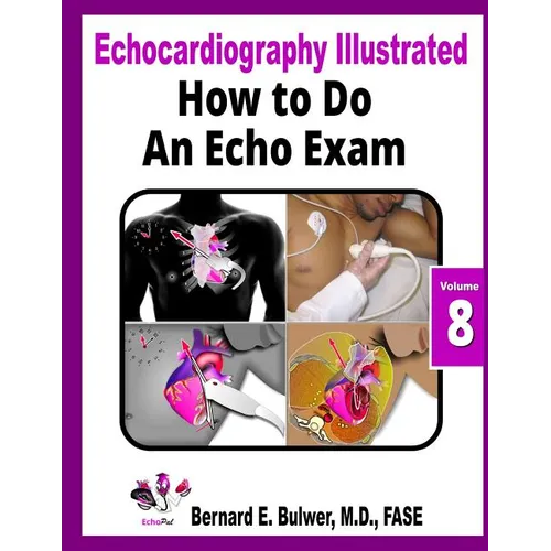 How to Do an Echo Exam - Paperback