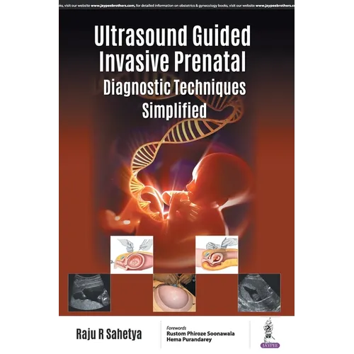 Ultrasound Guided Invasive Prenatal Diagnostic Techniques Simplified - Paperback