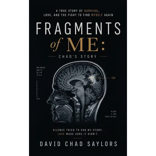 Fragments of Me Chad's Story - Hardcover
