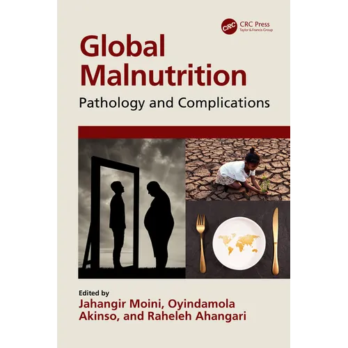 Global Malnutrition: Pathology and Complications - Paperback