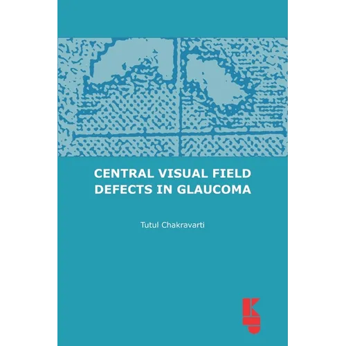 Central Visual Field Defects in Glaucoma - Paperback