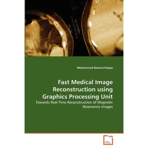 Fast Medical Image Reconstruction using Graphics Processing Unit - Paperback