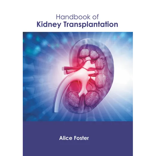Handbook of Kidney Transplantation - Hardcover