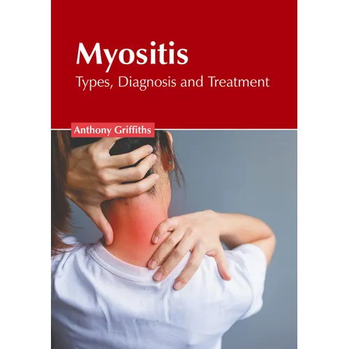 Myositis: Types, Diagnosis and Treatment - Hardcover