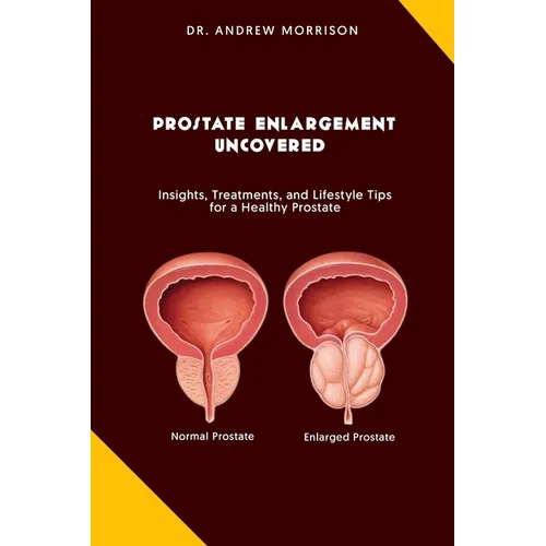Prostrate Enlargement Uncovered: Insights, Treatments, and Lifestyle Tips for a Healthy Prostate - Paperback