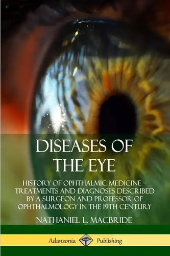 Diseases of the Eye: History of Ophthalmic Medicine - Treatments and Diagnoses Described by a Surgeon and Professor of Ophthalmology in the 19th Centu - Paperback