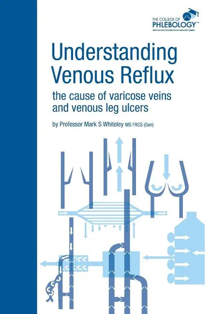 Understanding Venous Reflux the Cause of Varicose Veins and Venous Leg Ulcers: Varicose veins and venous leg ulcers - Paperback