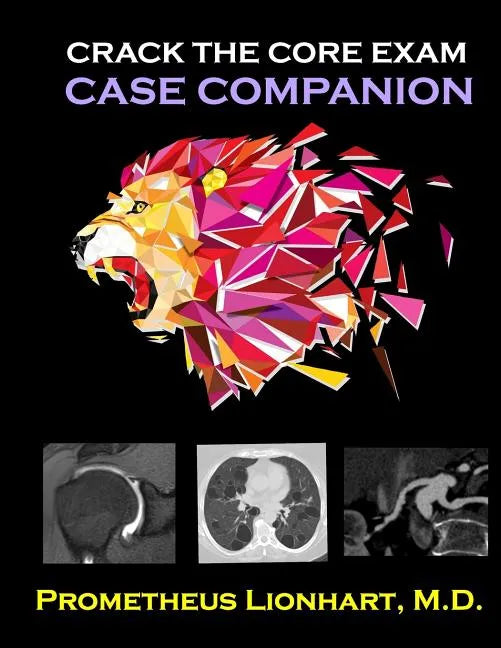 Crack the CORE Exam - Case Companion - Paperback