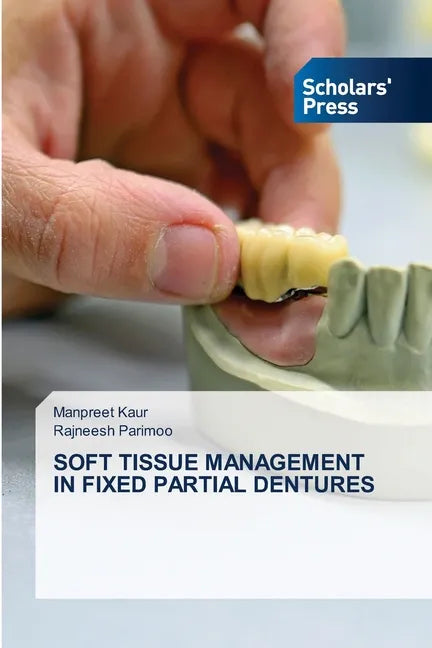 Soft Tissue Management in Fixed Partial Dentures - Paperback