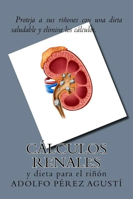 Cálculos renales: y dieta para el riñón - Paperback