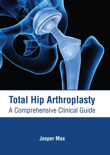Total Hip Arthroplasty: A Comprehensive Clinical Guide - Hardcover