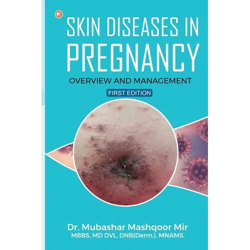 Skin Diseases in Pregnancy: Overview and Management - Paperback