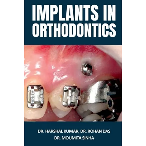 Implants in Orthodontics - Paperback