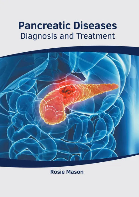 Pancreatic Diseases: Diagnosis and Treatment - Hardcover